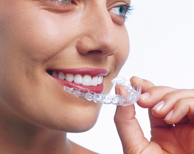 Invisalign Dentist Epping Dentist