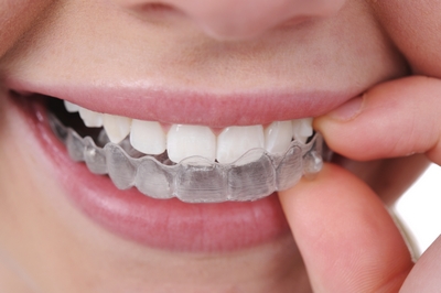 Invisalign Epping Dentist Epping