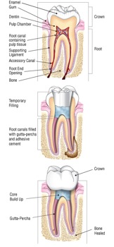 Root Canal Therapy Endodontics Epping Dentist Epping