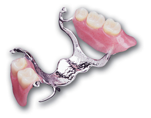 Partial Dentures Full Dentures Epping Dentist Epping