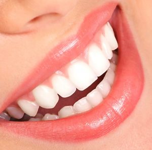 Teeth Whitening Epping Dentist Epping